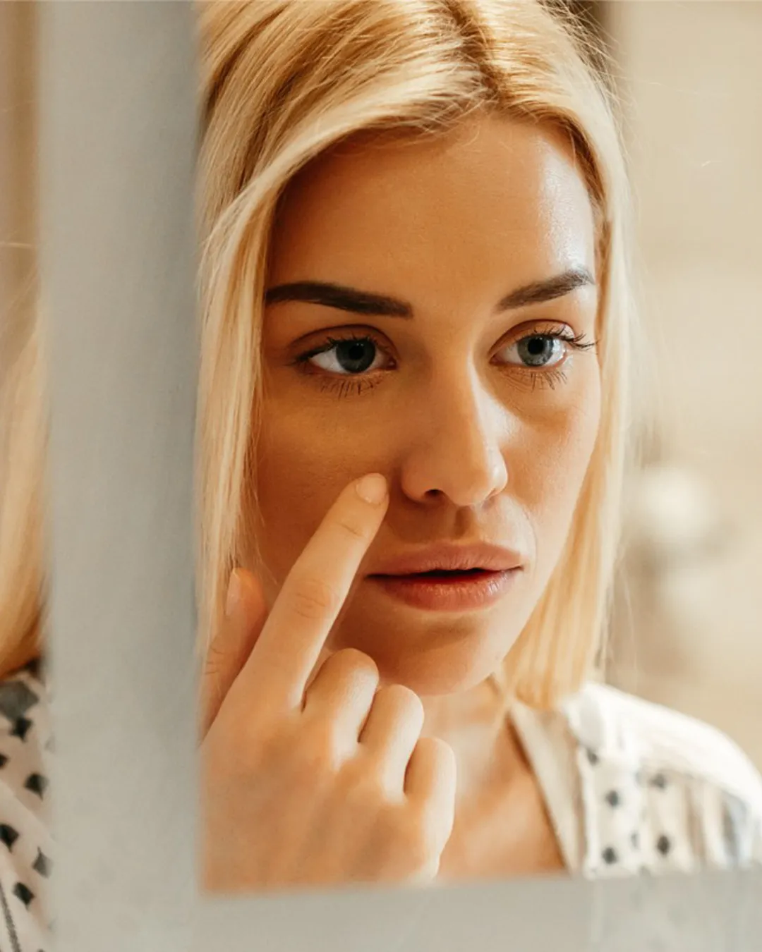 Skin Concern Enlarged-Pores 1