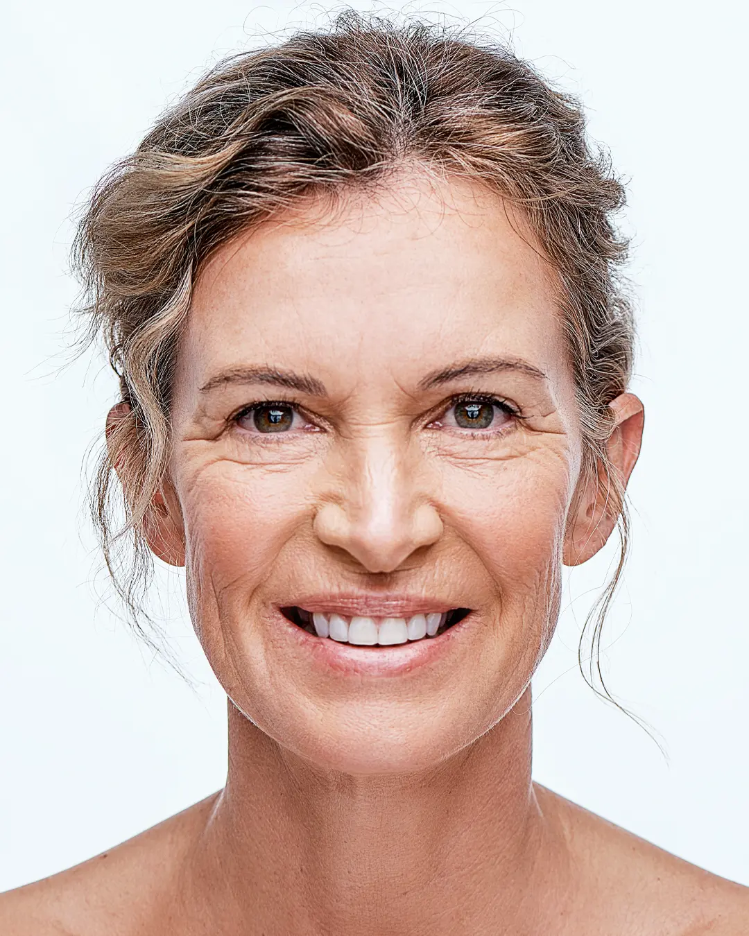 Skin Concern Sun-Damage Ageing 2