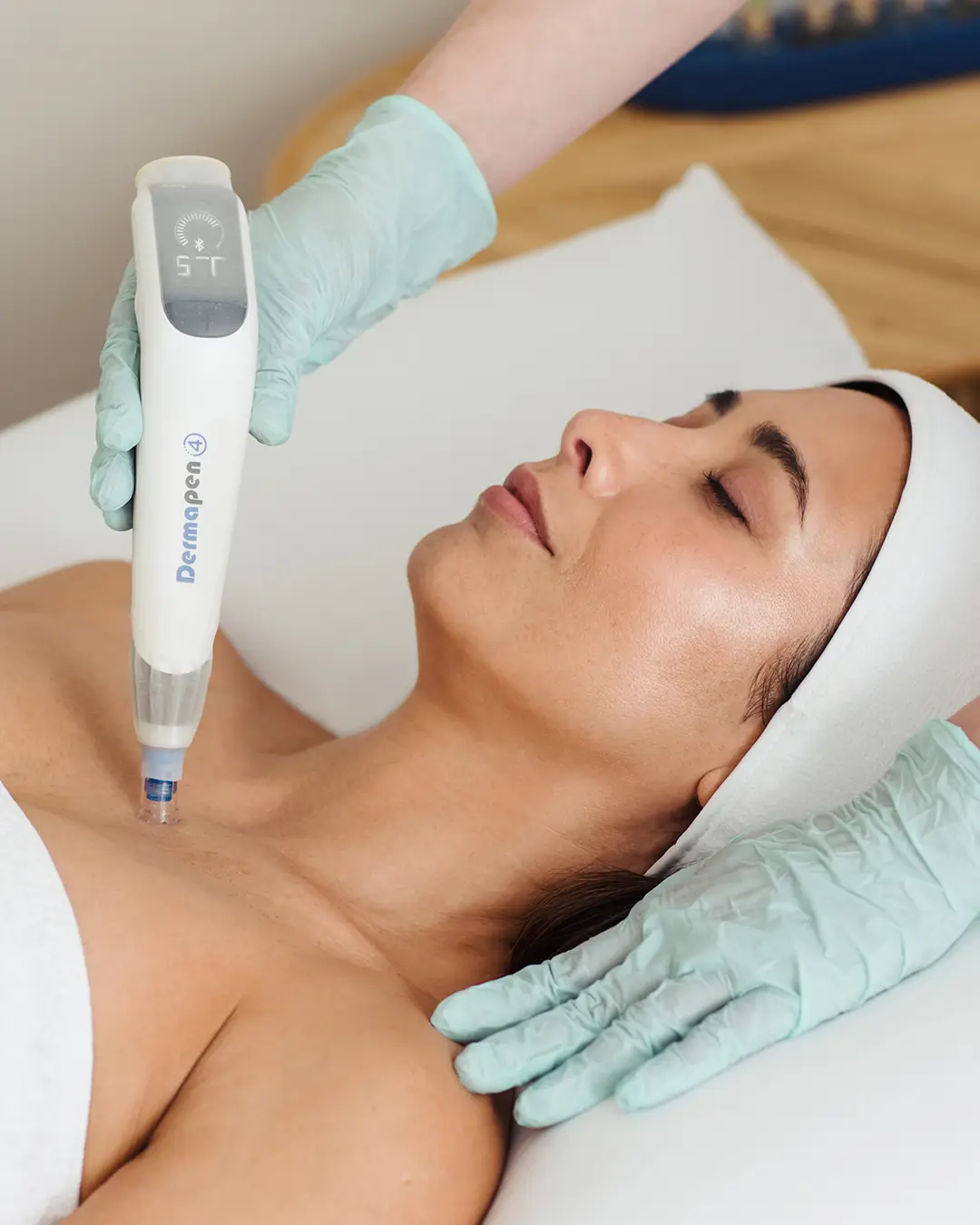 B-A Pages Microneedling Scar Setting