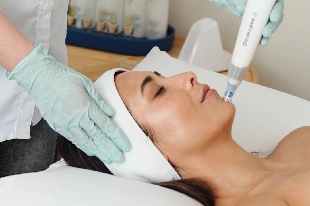 Dermapen Microneedling Pens Image