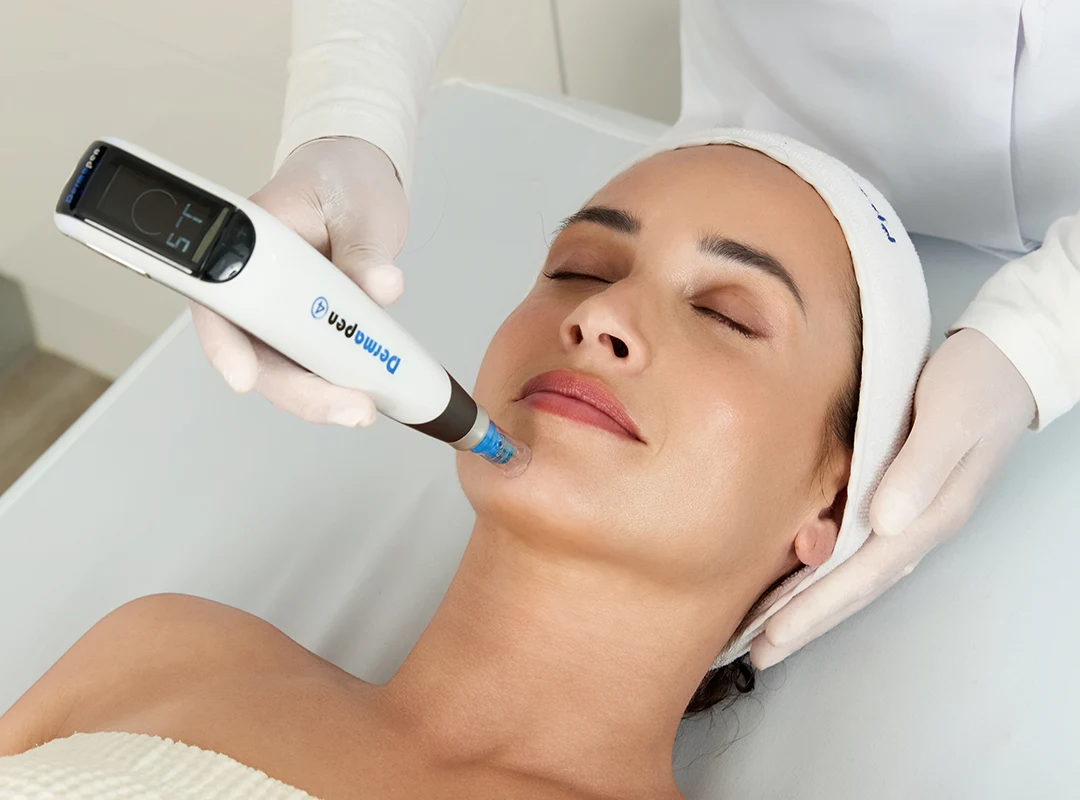 Tratament profesional de microneedling cu Dermapen 4