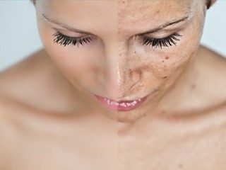 Unwanted-Pigmentation