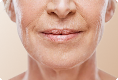 Linhas Finas & Rugas Image