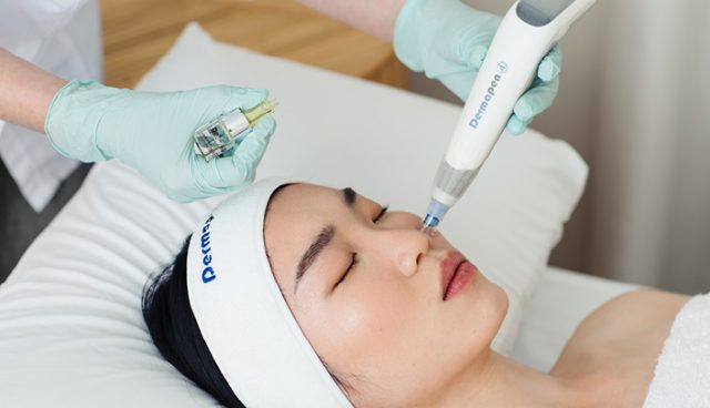 Skin Needling-640x368