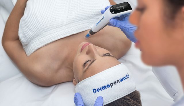 What-Microneedling-Does-640x368