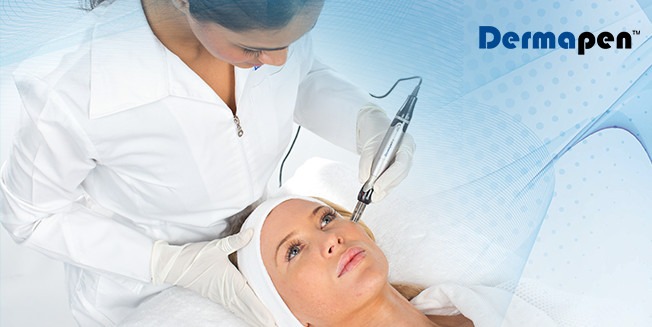 The-Dos-Micro-Needling-Blog-Image