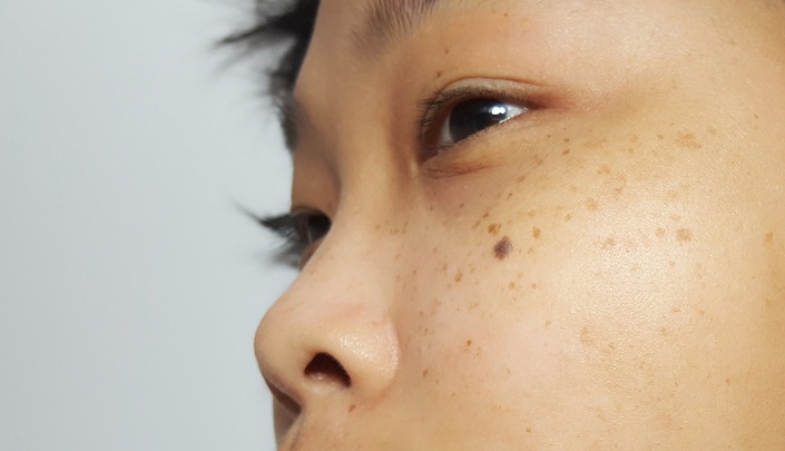 Best Poducts For Hyperpigmentation