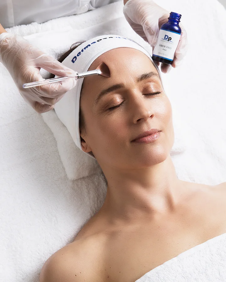 Image Uber Peels Dermapen Treatments