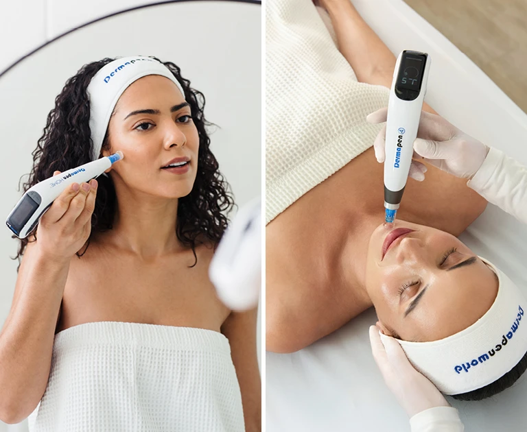 microneedling_at_home_vs_professional